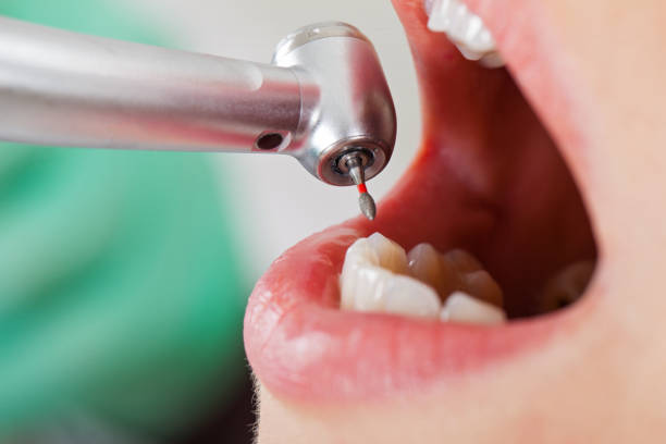 Best Urgent Tooth Repair  in Crestview, FL